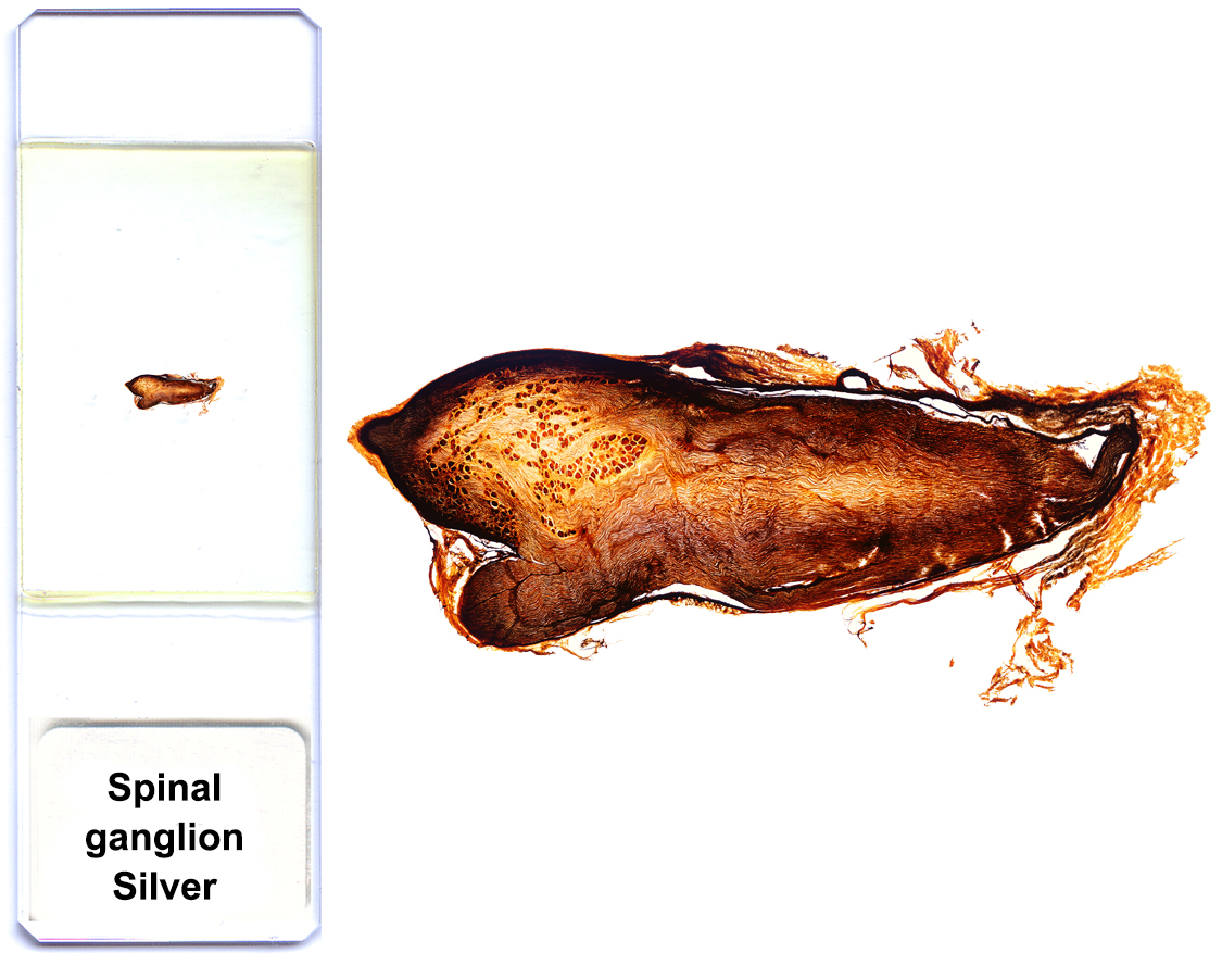 Shell Ganglion Nervous system I: Spinal cord and nerve ganglia